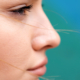 Close-up side profile of a woman’s nose and lips, showing smooth skin and natural nasal contour, used for educational content on revision rhinoplasty.
