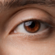 Close-up of a healthy lower eyelid showing the eyelid, eyelashes, and under-eye anatomy