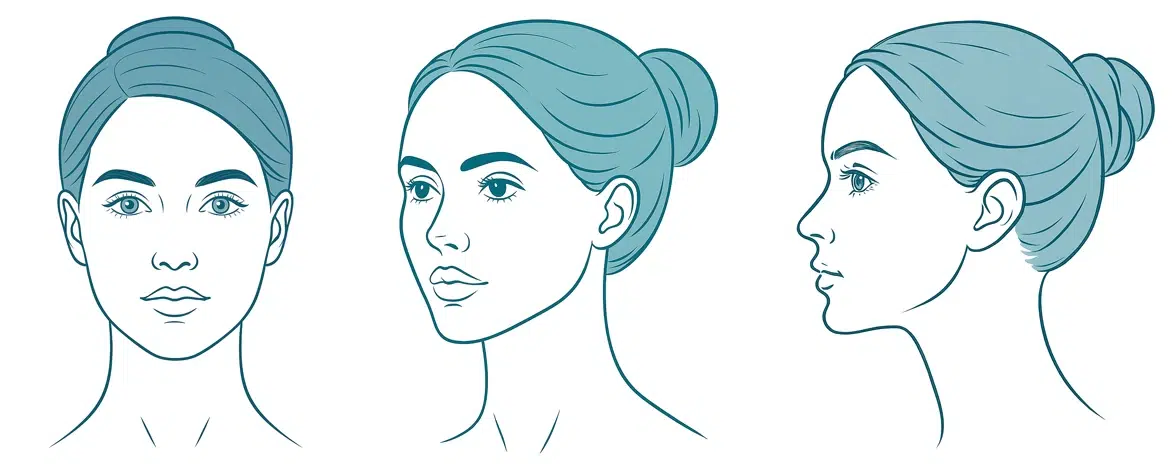 Teal line art illustrations of a woman’s face in three angles—front view, 3/4 view, and side profile—used to guide photo submissions for virtual cosmetic consultations.