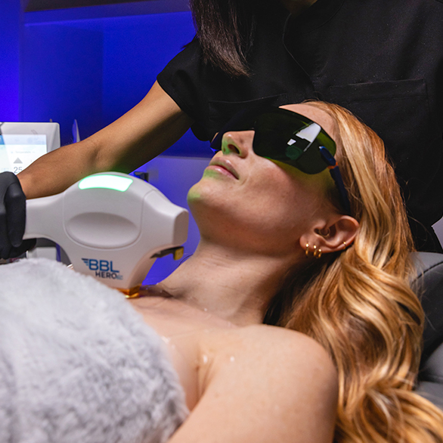 BroadBand Light treatment on the face with protective eyewear to reduce sun spots and redness
