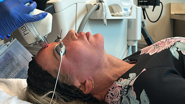 Patient undergoing a HALO® laser treatment for facial redness and visible vessels at Balikian Plastic Surgery, with protective eye shields and gentle cooling during the session