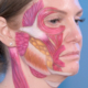 Facial anatomy hand-painted on a patient to demonstrate deep plane facelift structures