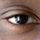 Close-up photograph of a human eye showing natural upper and lower eyelid anatomy with fine skin texture and subtle under-eye lines, illustrating eyelid aging and blepharoplasty recovery.